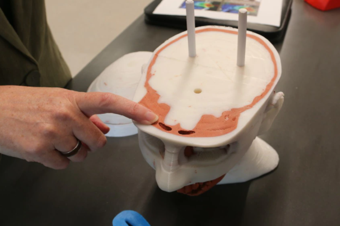 Brisbane bio-tech lab creates 'revolutionary' 3D-printed body parts to treat cancer patients